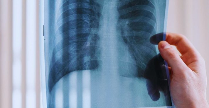 Descobrindo os Mecanismos do Câncer: Mutações, Poluição e Tratamentos Eficazes