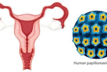 HPV: O vírus que afeta milhões e os riscos associados à falta de informação