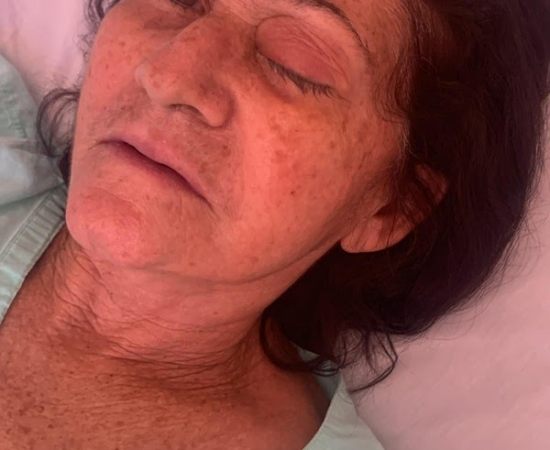 Mutirão de Catarata Deixa 8 Cegos no RN e Gera Revolta