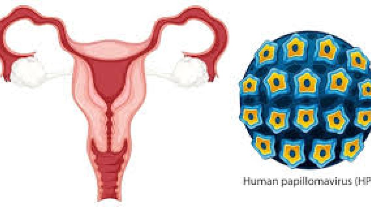 HPV: O vírus que afeta milhões e os riscos associados à falta de informação