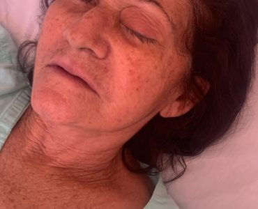 Desastre na Saúde: Mutirão de Catarata Deixa 8 Pessoas Cegas no RN e Gera Revolta!