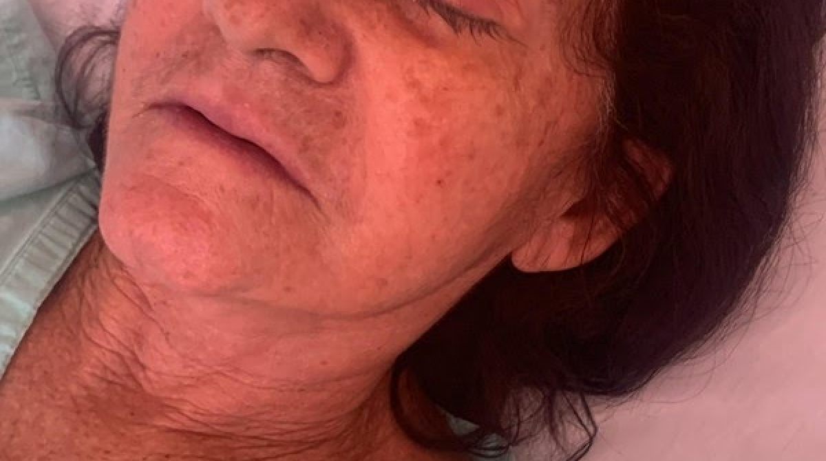 Desastre na Saúde: Mutirão de Catarata Deixa 8 Pessoas Cegas no RN e Gera Revolta!