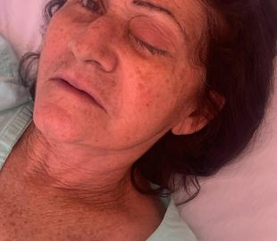 Desastre na Saúde: Mutirão de Catarata Deixa 8 Pessoas Cegas no RN e Gera Revolta!